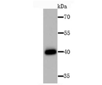 Western Blot: HLA Class I Antibody [NBP2-75928] - Western blot analysis of HLA Class I on Hela cell lysate using anti-HLA Class I antibody at 1/1,000 dilution.