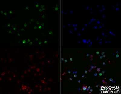 Immunocytochemistry/Immunofluorescence: HLA DMA Antibody (6B12NB) - Azide Free [NBP2-44304] - Daudi cells were fixed for 10 minutes using 10% formalin and then permeabilized for 5 minutes using 1X TBS + 0.5% Triton-X100.  The cells were incubated with anti-HLA DMA (6B12NB) at a 1:40 dilution overnight at 4C and detected with an anti-mouse Dylight 488 (Green) at a 1:500 dilution.  Actin was detected with Phalloidin 568 (Red) at a 1:200 dilution.  Nuclei were counterstained with DAPI (Blue).  Cells were imaged using a 40X objective.