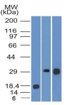 Western Blot: HLA DMA Antibody (6B12NB) - Azide Free [NBP2-44304] - Western blot analysis of (A) partial recombinant human HLA DMA protein, and lysates of (B) Ramos cells and (C) Raji cells using 1:500 dilution of HLA DMA antibody (clone 6B12NB) Image using the standard format of this product.