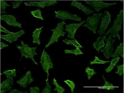 Immunocytochemistry/Immunofluorescence: HLA DMB Antibody (5G11) [H00003109-M06] - Analysis of monoclonal antibody to HLA-DMB on HeLa cell. Antibody concentration 10 ug/ml