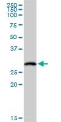 Western Blot: HLA DOB Antibody [H00003112-D01P] - Analysis of HLA-DOB expression in human placenta.