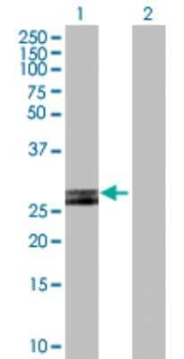 Western Blot: HLA DOB Antibody [H00003112-D01P] - Analysis of HLA-DOB expression in transfected 293T cell line by HLA-DOB polyclonal antibody.Lane 1: HLA-DOB transfected lysate(30.80 KDa).Lane 2: Non-transfected lysate.
