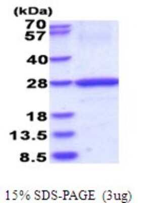 SDS-Page: HLA DOB Recombinant Protein [NBP2-51696] - 15% SDS Page (3 ug)