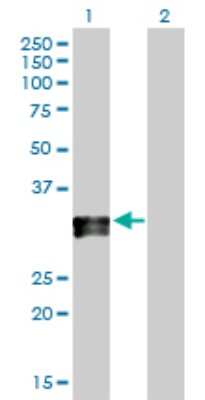 Western Blot: HLA DPA Antibody [H00003113-D01P] - Analysis of HLA-DPA1 expression in transfected 293T cell line by HLA-DPA1 polyclonal antibody.Lane 1: HLA-DPA1 transfected lysate(29.30 KDa).Lane 2: Non-transfected lysate.