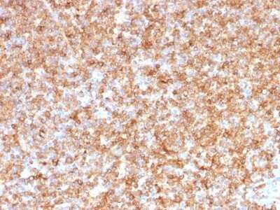 Immunohistochemistry-Paraffin: HLA DQ/DR/DP Antibody (CR3/43) - Azide and BSA Free [NBP2-54507] - Formalin-fixed, paraffin-embedded human Tonsil stained with HLA DQ/DR/DP Monoclonal Antibody (CR3/43).