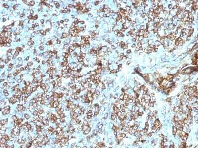 Immunohistochemistry-Paraffin: HLA DQ/DR/DP Antibody (CR3/43) - Azide and BSA Free [NBP2-54507] - Formalin-fixed, paraffin-embedded human Tonsil stained with HLA DQ/DR/DP Monoclonal Antibody (CR3/43).