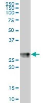 Western Blot: HLA DPB1 Antibody [H00003115-B01P] - Analysis of HLA-DPB1 expression in human spleen.