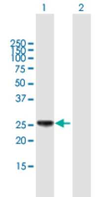 Western Blot: HLA DPB1 Antibody [H00003115-B01P] - Analysis of HLA-DPB1 expression in transfected 293T cell line by HLA-DPB1 polyclonal antibody.  Lane 1: HLA-DPB1 transfected lysate(28.38 KDa). Lane 2: Non-transfected lysate.
