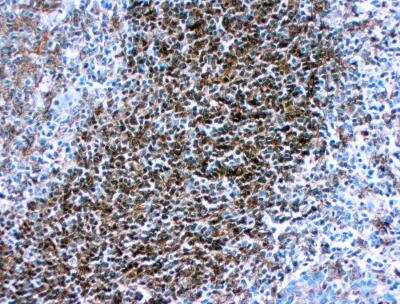 Immunohistochemistry-Paraffin: HLA DQ/DR/DP Antibody (CR3/43) [NB120-17101] - Formalin fixed paraffin embedded human tonsil stained with HLA-DR antibody (NB120-17101).