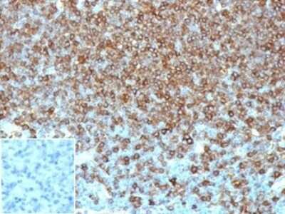 Immunohistochemistry-Paraffin: HLA DQ/DR/DP Antibody (HLA-Pan/6663) [NBP3-13905] - Formalin-fixed, paraffin-embedded human lymph node stained with HLA DQ/DR/DP antibody (HLA-Pan/6663). Inset: PBS instead of primary, secondary negative control.