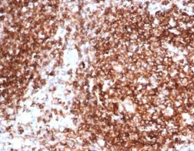 Immunohistochemistry-Paraffin: HLA DQ/DR/DP Antibody (HLA-Pan/6663) [NBP3-13905] - Formalin-fixed, paraffin-embedded human tonsil stained with HLA DQ/DR/DP antibody (HLA-Pan/6663).