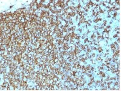 Immunohistochemistry-Paraffin: HLA DQ/DR/DP Antibody (rHLA-Pan/3475) - Azide and BSA Free [NBP3-08644] - Formalin-fixed, paraffin-embedded human Tonsil stained with HLA DQ/DR/DP Mouse Recombinant Monoclonal Antibody (rHLA DQ/DR/DP/3475).