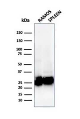 Western Blot: HLA DQ/DR/DP Antibody (rHLA-Pan/3475) - Azide and BSA Free [NBP3-08644] - Western Blot Analysis of (1) Ramos cell and (2) human spleen tissue lysate using HLA DQ/DR/DP antibody (rHLA-Pan/3475).