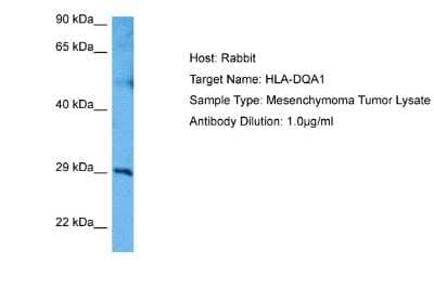 Western Blot: HLA DQ3 Antibody [NBP2-84068] - Host: Rabbit. Target Name: HLA-DQA1. Sample Tissue: Human Mesenchymoma Tumor lysates. Antibody Dilution: 1ug/ml