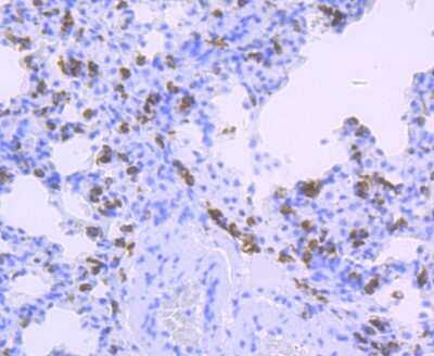 Immunohistochemistry-Paraffin: HLA DQA1 Antibody (JU17-34) [NBP2-75525] - Analysis of paraffin-embedded rat lung tissue using anti-HLA-DQA1 antibody. Counter stained with hematoxylin.