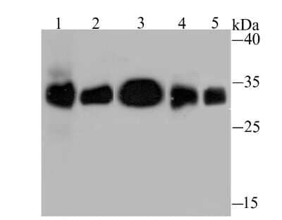 Western Blot: HLA DQA1 Antibody (JU17-34) [NBP2-75525] - Analysis of HLA-DQA1 on different lysates using anti-HLA-DQA1 antibody at 1/1,000 dilution.Positive control:Lane 1: Rat lung          Lane 2: Rat skin   Lane 3: Mouse thymus      Lane 4: Mouse spleenLane 5: Raji