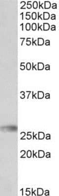 Western Blot HLA DQA2 Antibody