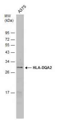 Western Blot HLA DQA2 Antibody