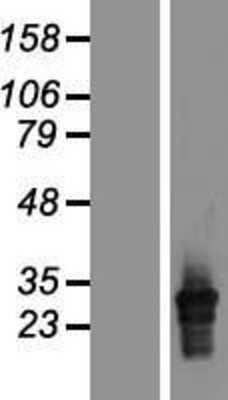 Western Blot HLA DQA2 Overexpression Lysate