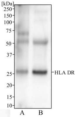 Western Blot: HLA-DR Antibody (L243) - Azide and BSA Free [NBP2-80773] - Analysis of human spleen (A) and human tonsil (B) tissue using HLA-DR antibody at 2 ug/mL. Image from the standard format of this antibody.