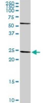 Western Blot: HLA-DR Antibody [H00003122-D01P] - Analysis of HLA-DRA expression in A-431.