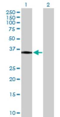 Western Blot: HLA-DR Antibody [H00003122-D01P] - Analysis of HLA-DRA expression in transfected 293T cell line by HLA-DRA polyclonal antibody.Lane 1: HLA-DRA transfected lysate(28.60 KDa).Lane 2: Non-transfected lysate.