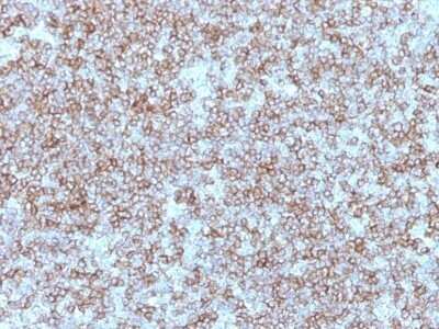 Immunohistochemistry-Paraffin: HLA DR/DP Antibody (Bra-14) - IHC-Prediluted [NBP2-48105] - Human Tonsil stained with HLA-DP/DR Monoclonal Antibody (Bra-14).