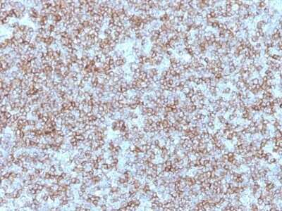 Immunohistochemistry-Paraffin: HLA DR/DP Antibody (Bra-14) [NBP2-44985] - Human Tonsil stained with HLA-DP/DR Monoclonal Antibody (Bra-14).