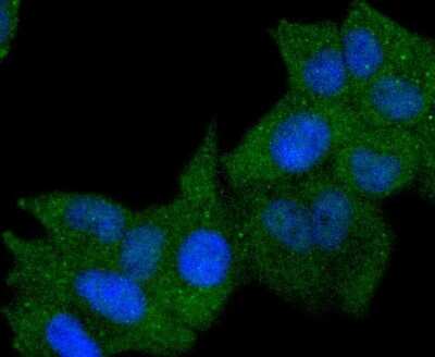 Immunocytochemistry/Immunofluorescence: HLA DR/DP Antibody (SC06-78) [NBP2-67610] - Staining HLA-DR in Hela cells (green). The nuclear counter stain is DAPI (blue). Cells were fixed in paraformaldehyde, permeabilised with 0.25% Triton X100/PBS.