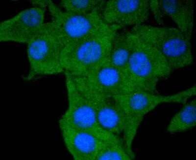 Immunocytochemistry/Immunofluorescence: HLA DR/DP Antibody (SC06-78) [NBP2-67610] - Staining HLA-DR in B16-F1 cells (green). The nuclear counter stain is DAPI (blue). Cells were fixed in paraformaldehyde, permeabilised with 0.25% Triton X100/PBS.