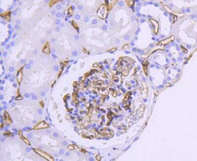 Immunohistochemistry-Paraffin: HLA DR/DP Antibody (SC06-78) [NBP2-67610] - Analysis of paraffin-embedded human kidney tissue using anti-HLA-DR antibody. Counter stained with hematoxylin.