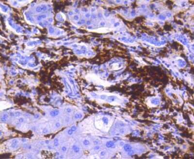 Immunohistochemistry-Paraffin: HLA DR/DP Antibody (SC06-78) [NBP2-67610] - Analysis of paraffin-embedded human liver tissue using anti-HLA-DR antibody. Counter stained with hematoxylin.