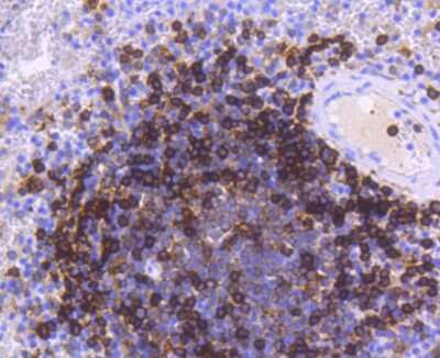 Immunohistochemistry-Paraffin: HLA DR/DP Antibody (SC06-78) [NBP2-67610] - Analysis of paraffin-embedded human spleen tissue using anti-HLA-DR antibody. Counter stained with hematoxylin.