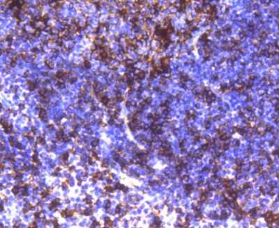 Immunohistochemistry-Paraffin: HLA DR/DP Antibody (SC06-78) [NBP2-67610] - Analysis of paraffin-embedded human tonsil tissue using anti-HLA-DR antibody. Counter stained with hematoxylin.