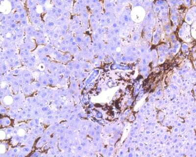 Immunohistochemistry-Paraffin: HLA DR/DP Antibody (SC06-78) [NBP2-67610] - Immunohistochemical analysis of paraffin-embedded human liver tissue using anti-HLA DR/DP antibody. The section was pre-treated using heat mediated antigen retrieval with Tris-EDTA buffer (pH 8.0-8.4) for 20 minutes. The tissues were blocked in 5% BSA for 30 minutes at room temperature, washed with ddH2O and PBS, and then probed with the primary antibody (ET1610-66, 1/200) for 30 minutes at room temperature. The detection was performed using an HRP conjugated compact polymer system. DAB was used as the chromogen. Tissues were counterstained with hematoxylin and mounted with DPX.