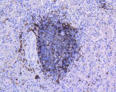 Immunohistochemistry-Paraffin: HLA DR/DP Antibody (SC06-78) [NBP2-67610] - Immunohistochemical analysis of paraffin-embedded human spleen tissue using anti-HLA DR/DP antibody. The section was pre-treated using heat mediated antigen retrieval with Tris-EDTA buffer (pH 8.0-8.4) for 20 minutes. The tissues were blocked in 5% BSA for 30 minutes at room temperature, washed with ddH2O and PBS, and then probed with the primary antibody (ET1610-66, 1/200) for 30 minutes at room temperature. The detection was performed using an HRP conjugated compact polymer system. DAB was used as the chromogen. Tissues were counterstained with hematoxylin and mounted with DPX.