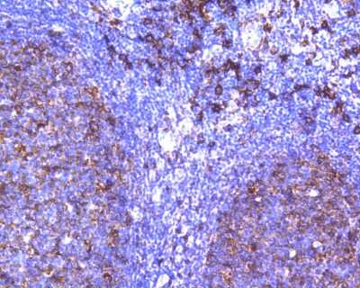 Immunohistochemistry-Paraffin: HLA DR/DP Antibody (SC06-78) [NBP2-67610] - Immunohistochemical analysis of paraffin-embedded human tonsil tissue using anti-HLA DR/DP antibody. The section was pre-treated using heat mediated antigen retrieval with Tris-EDTA buffer (pH 8.0-8.4) for 20 minutes. The tissues were blocked in 5% BSA for 30 minutes at room temperature, washed with ddH2O and PBS, and then probed with the primary antibody (ET1610-66, 1/200) for 30 minutes at room temperature. The detection was performed using an HRP conjugated compact polymer system. DAB was used as the chromogen. Tissues were counterstained with hematoxylin and mounted with DPX.