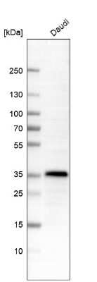 Western Blot: HLA DRA Antibody (CL10961) [NBP3-07996] - Analysis in human cell line Daudi.