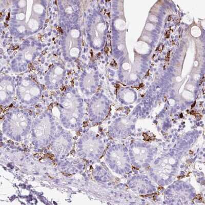 Immunohistochemistry-Paraffin: HLA DRA Antibody [NBP2-38619] - Staining of human small intestine shows membranous positivity in lymphoid cells.