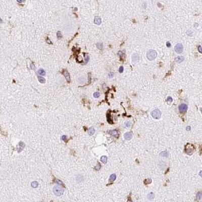 Immunohistochemistry-Paraffin: HLA DRA Antibody [NBP2-38619] - Staining of human cerebral cortex.