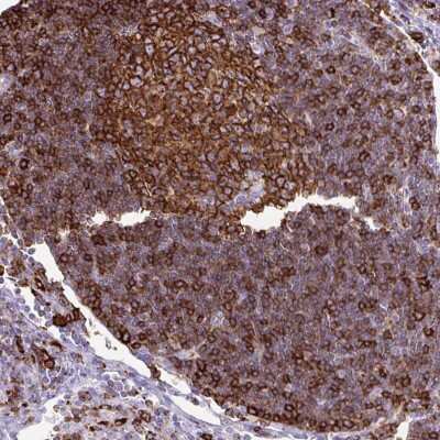 Immunohistochemistry-Paraffin: HLA DRA Antibody [NBP2-38691] - Staining of human lymph node shows membranous positivity in lymphoid cells.