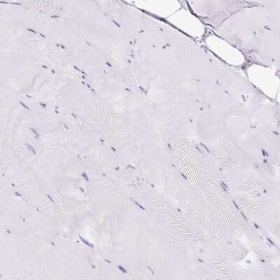 Immunohistochemistry-Paraffin: HLA DRA Antibody [NBP2-38691] - Staining of human skeletal muscle shows no positivity in myocytes.