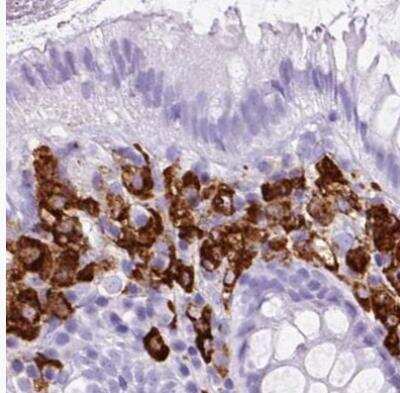 Immunohistochemistry-Paraffin: HLA DRA Antibody [NBP2-38691] - Staining of human colon using Anti-HLA-DRA antibody.