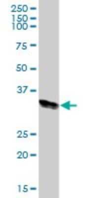 Western Blot: HLA DRA Antibody [H00003122-B01P] - Analysis of HLA-DRA expression in human kidney.