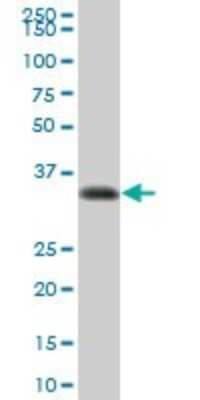 Western Blot: HLA DRA Antibody [H00003122-B01P] - Analysis of HLA-DRA expression in human spleen.