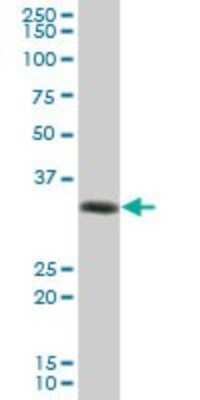 Western Blot: HLA DRA Antibody [H00003122-B02P] - Analysis of HLA-DRA expression in human spleen.