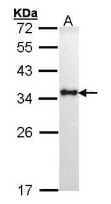 Western Blot: HLA DRA Antibody [NBP1-31512] - Sample (30 ug of whole cell lysate) A: H1299 12% SDS PAGE; antibody diluted at 1:1000.