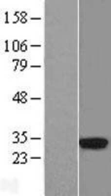 Western Blot HLA DRA Overexpression Lysate