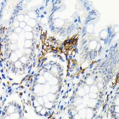 Immunohistochemistry-Paraffin: HLA DRB1 Antibody (6Z1F10) [NBP3-15950] - Immunohistochemistry of paraffin-embedded human colon using HLA DRB1 Rabbit mAb (NBP3-15950) at dilution of 1:100 (40x lens).Perform microwave antigen retrieval with 10 mM Tris/EDTA buffer pH 9.0 before commencing with IHC staining protocol.