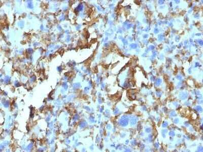 Immunohistochemistry-Paraffin: HLA DRB1 Antibody (HLA-DRB/1067) - Azide and BSA Free [NBP2-47671] - Human Histiocytoma stained with HLA-DRB Monoclonal Antibody (HLA-DRB/1067).